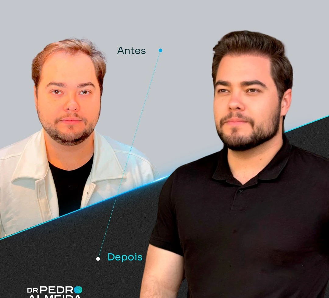 Erste Folie - Vorher und Nachher