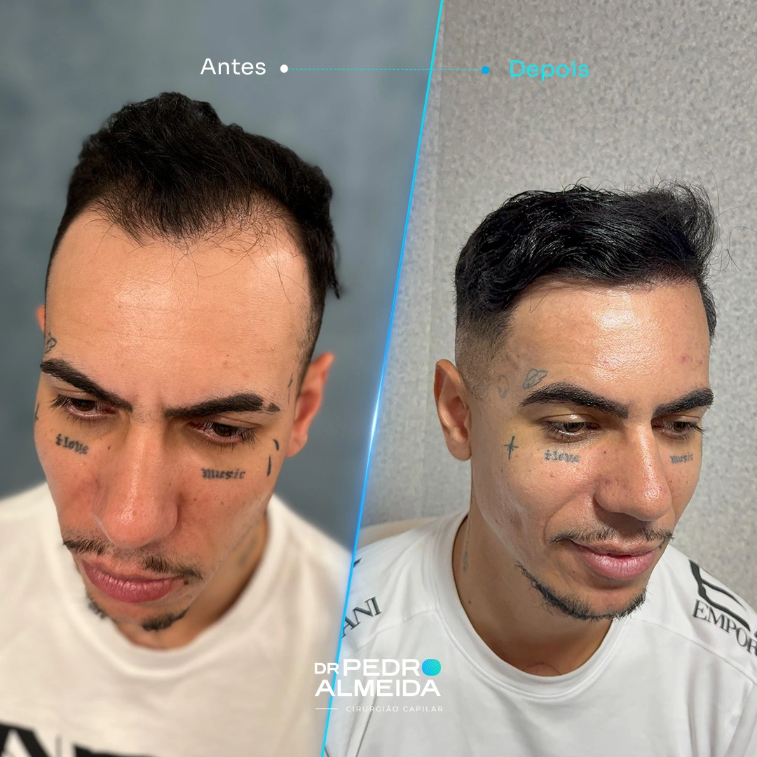 Dritte Folie - Vorher und Nachher